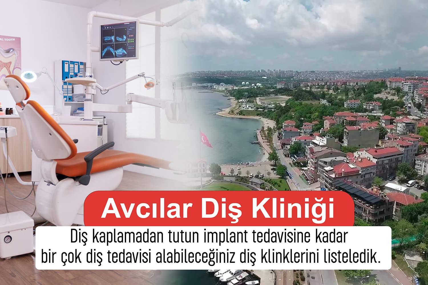Avcılar Porselen Diş Kaplama Fiyatları